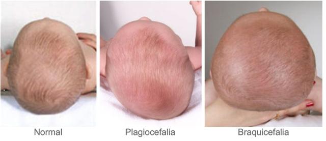 81189-COJIN JANE PLAGIOCEFALIA(16-5)-2